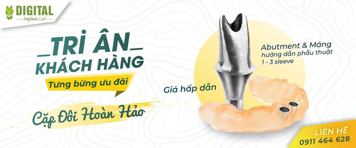 Digital Implant Lab Tri ân khách hàng - nhận ngàn ưu đãi