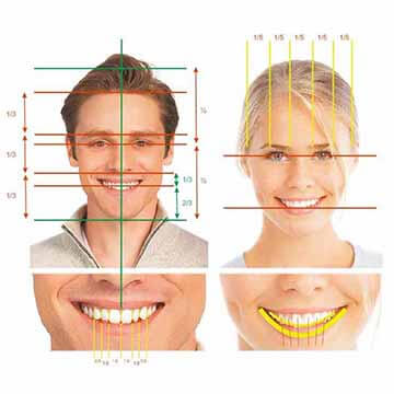Kỹ thuật thiết kế nụ cười Smile Design