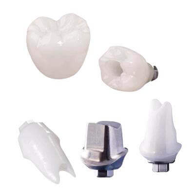 Phục hình sứ trên Implant